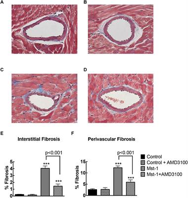 CXCR4 Antagonism Reduces Cardiac Fibrosis and Improves Cardiac Performance in Dilated Cardiomyopathy
